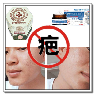 去手术修复增生性凸巴疙瘩烧伤药烟烫疤痕印缝针抓痕摔伤撞伤产品