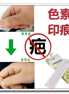 祛凹凸疤去除黑色素沉淀红印伤疤贴淡化黑印痘疤痕印修复药膏正品