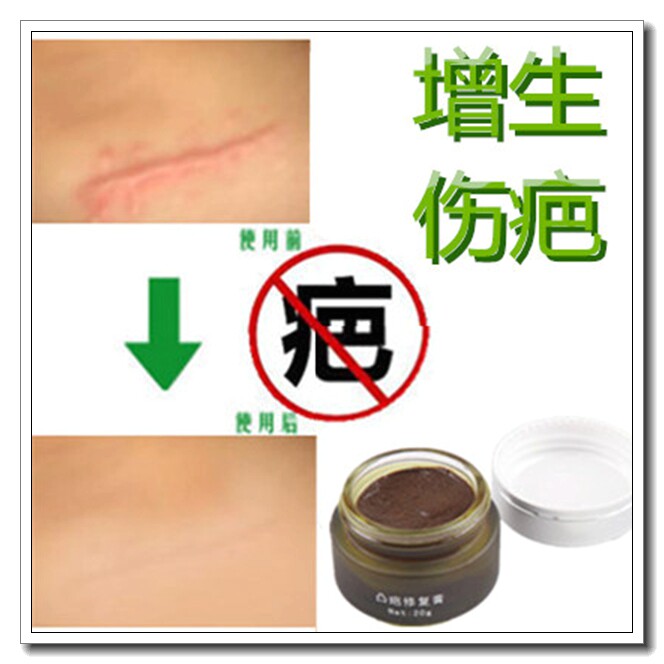 去芭膏修复祛除脸部烫伤疤痕灵正品默氏疤复平手术黑色素沉淀凝胶