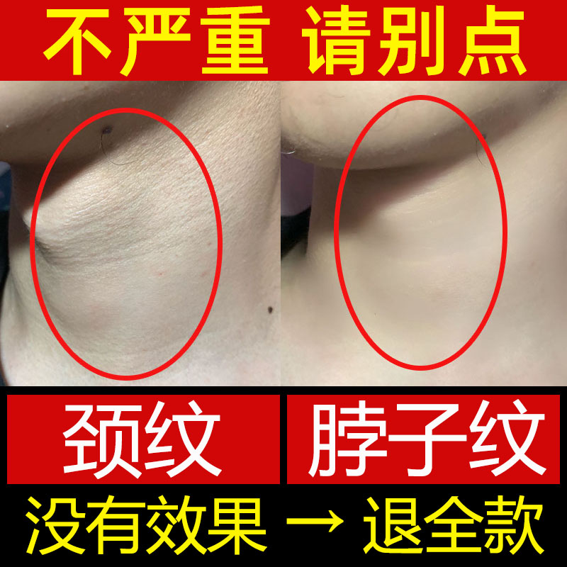颈纹霜去颈纹神器提拉紧致图片