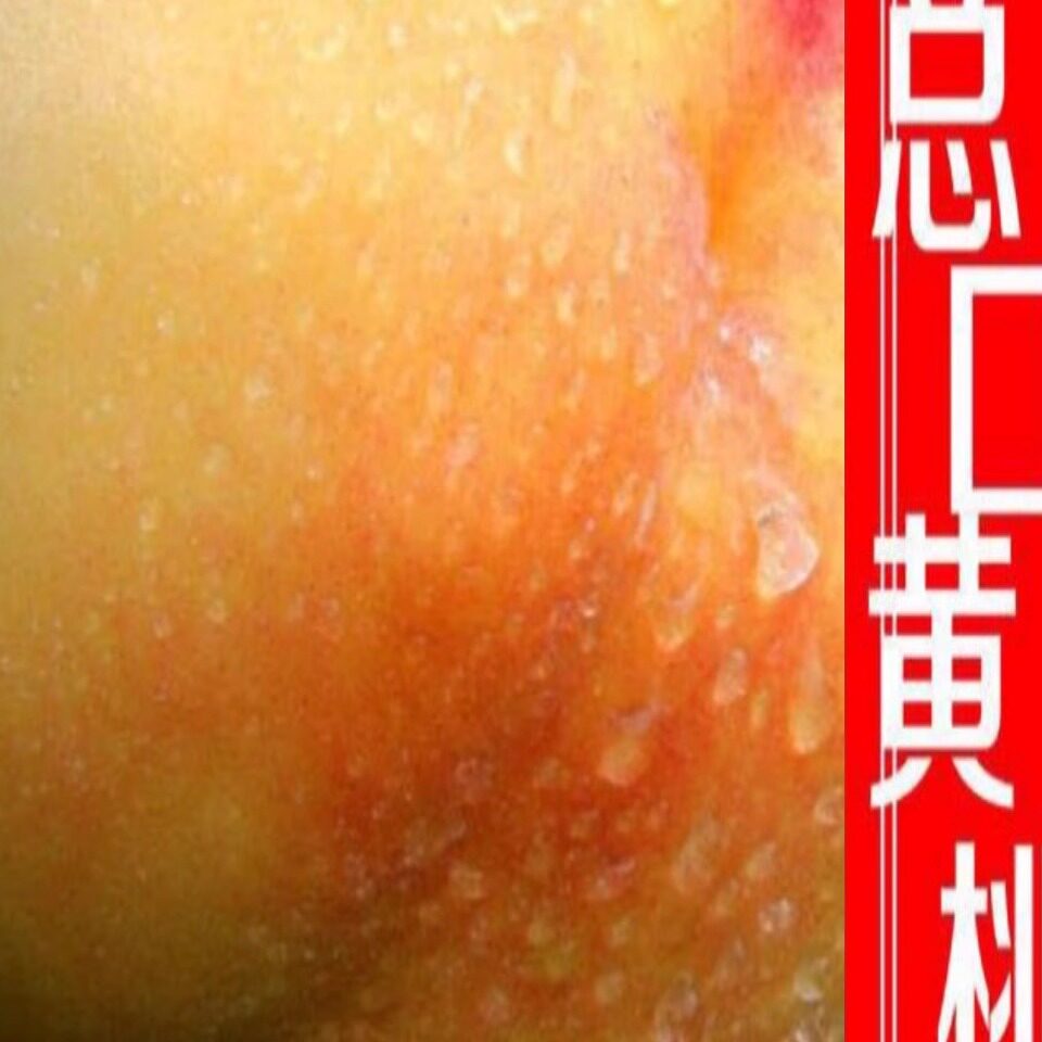 正宗湖北潜江总口新鲜大