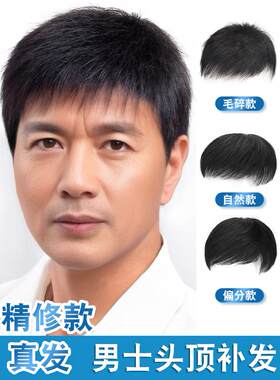 假发男短发真人发男士秃顶前额头顶补发块隐形无痕自然帅气补发片