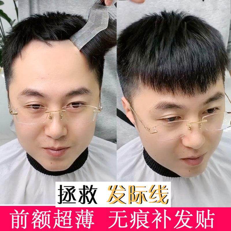 发际线假发贴短发贴男士假发前额秃顶补发隐形无痕生物头皮浏海片