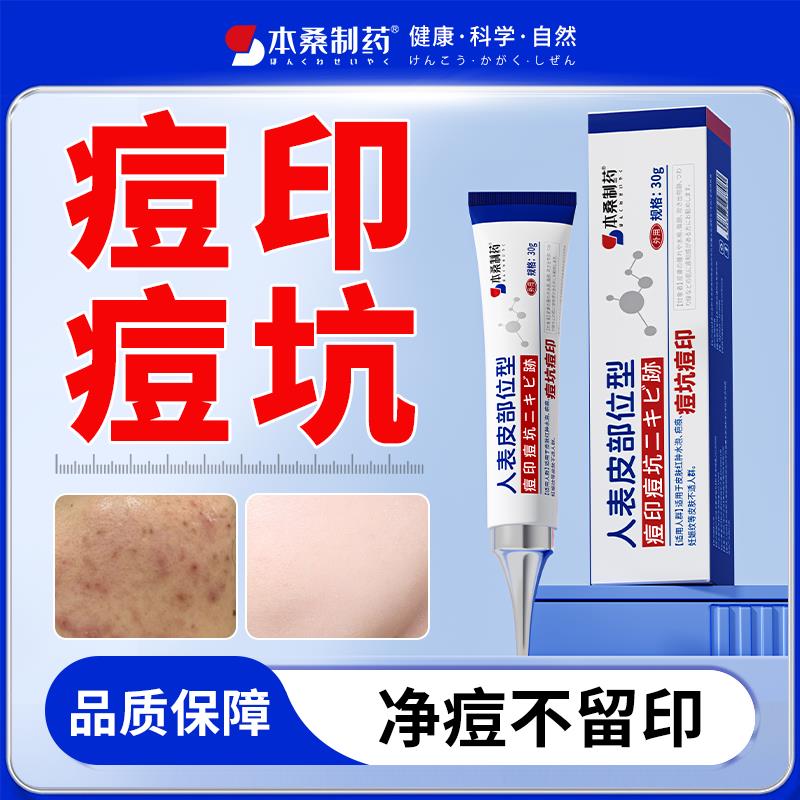 祛痘印痘坑凹洞修覆膏淡化男生男士生长因子痘痘消炎粉刺闭口青春