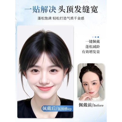 【无需发夹】假发女片头顶补发彷真发增发量前额无边浏海魔术贴片