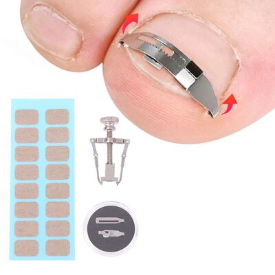 1 Set Ingrown Toenail Corrector Tools Pedicure Recover