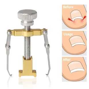 Ingrown Toenail Corrector Straightening Clip Pedicure Foot