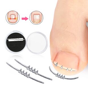 Tool Corrector Toenail Care Toe Nail Embed Ingrown