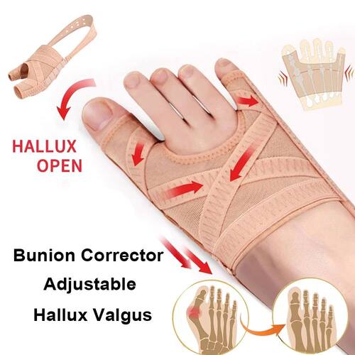 Hallux Valgus Bunion Corrector Toe Separator Orthotics Feet