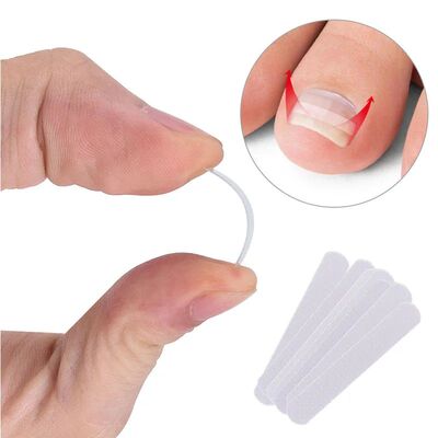 10pcs Ingrown Toenail Correction Tool Ingrown Toe Nail