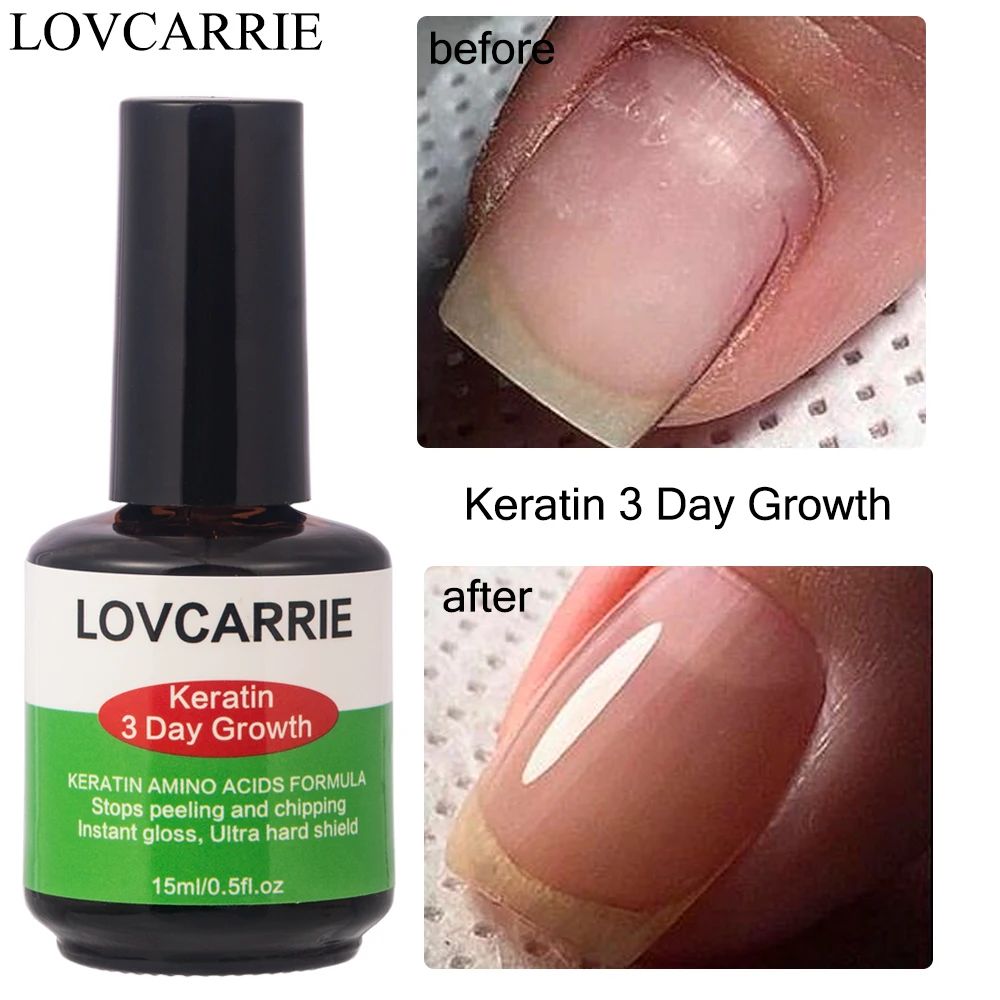 Keratin Nail atment Growth Formula Protein Normal Nail