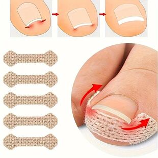Corrector Toenail Paronychia 10pcs Anti Strips Ingrown