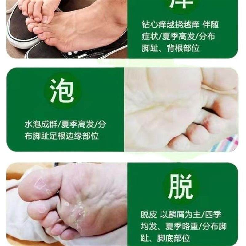百修福藓疥灵冷敷抑菌乳膏温和配方成人手脚脱买3支送1买5瓶1瓶,保健用品,皮肤消毒护理（消）,淘宝优惠券,粉丝福利购,淘宝优惠卷