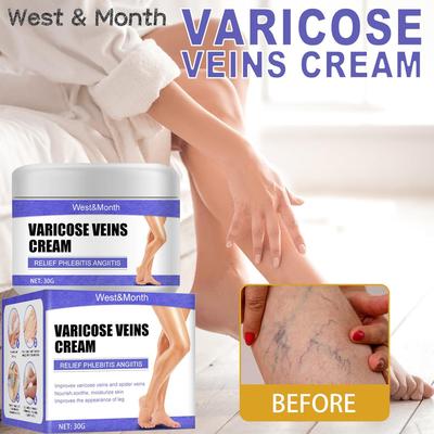 WestMonth 腿部静脉修护霜 曲张蚯蚓腿青筋凸起疼痛腿部护理霜