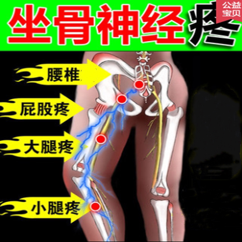 关节膏药圣肤堂苗药古方腰腿关节