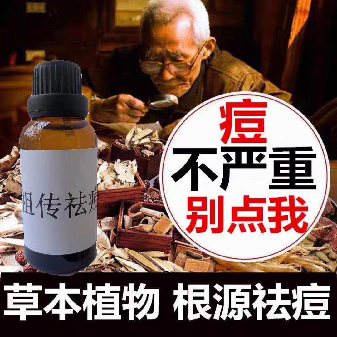 祛痘精华去严重痤疮痘痘前胸脸部后背下巴长淡化痘印闭口粉刺神器