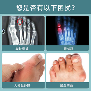 伊登大小脚趾固定器下地走路支具拖鞋石膏夹板脚趾矫正器护具