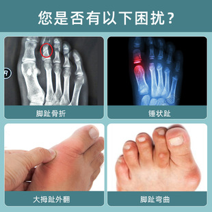 伊登大小脚趾固定器下地走路支具拖鞋石膏夹板脚趾矫正器护具
