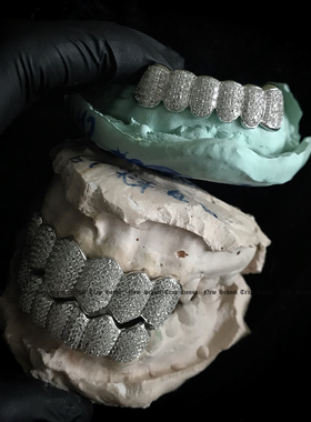 莫桑石定制牙套Grillz嘻哈hiphop珠宝嘻哈大金牙Custom jewelry