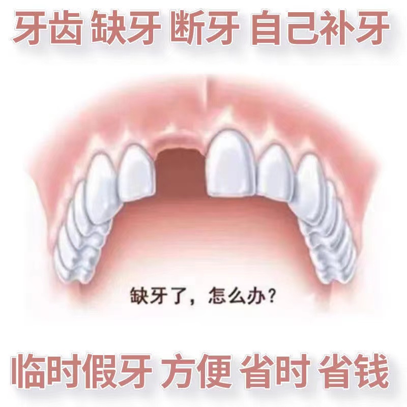 自制假牙单颗套仿真烤瓷一颗饰牙缝牙齿门牙缺牙材料新款上市树脂 美容美体仪器 其它口腔护理设备 原图主图