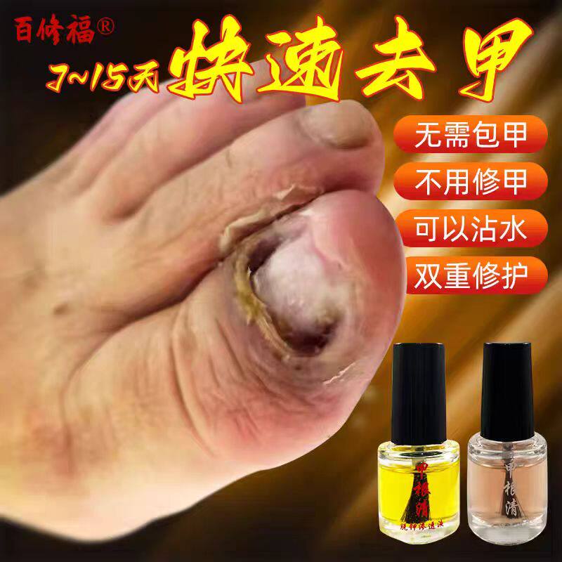 百修福甲根清脱甲精油脱甲精油无痛去坏甲祛甲精油实体店全程指导