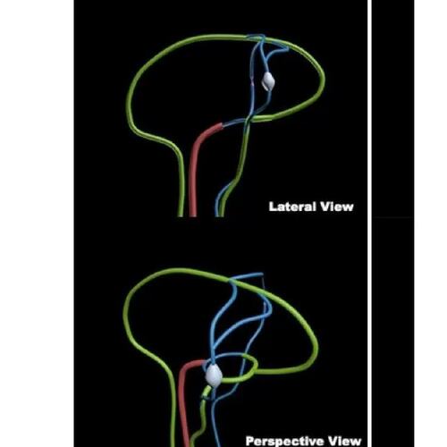 议价WEK-BV脑血管模体，Brain Vesse模体定制，脑肿瘤血管模体