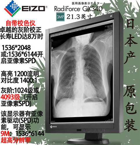crdr医用显示器医疗艺卓