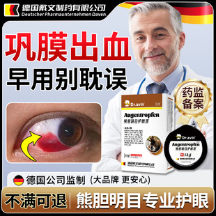 结膜下出血眼底巩膜充血过敏性结膜炎眼睛血管破裂可搭滴眼液YJ