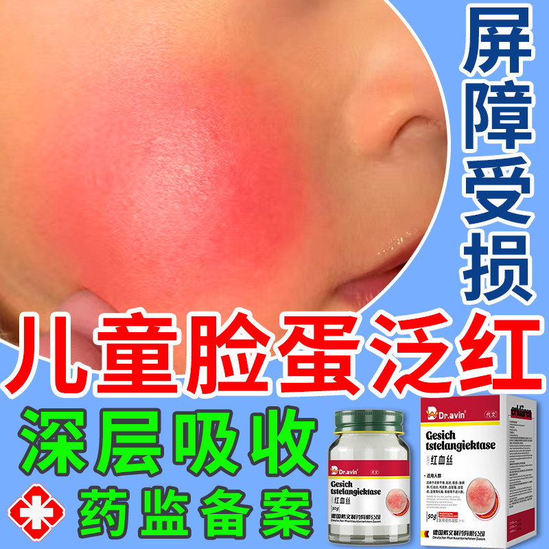 代文红脸蛋儿童宝宝发烫红血丝膏红疹角质层敏感肌肤增厚医用去E8