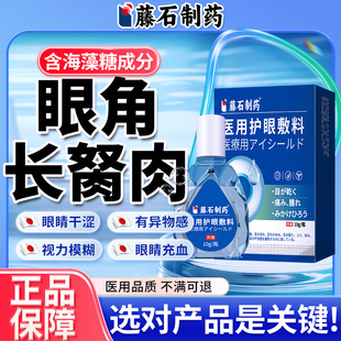 去除眼睛胬肉可搭滴眼液眼角长翼状胬肉眼药水息肉眼异物感模糊YJ