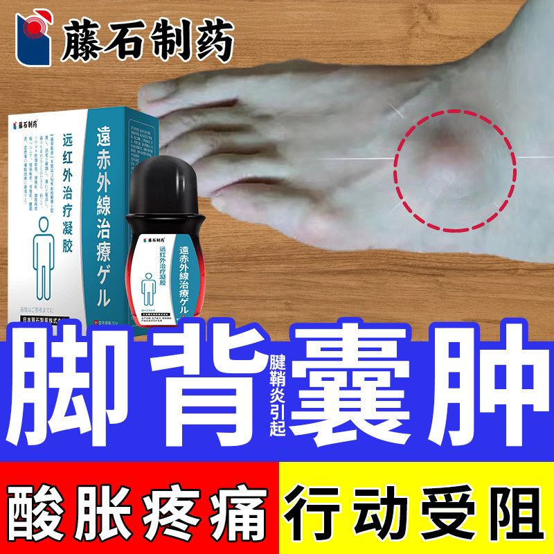 脚背腱鞘囊肿贴鼓包健稍鞘炎护腕手腕腱鞘炎舒筋可搭专用膏贴YU