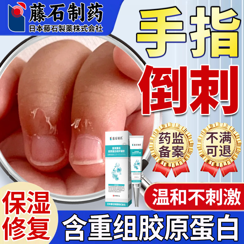 手上长倒刺手指倒刺贴儿童起皮保护指甲边缘干裂脱皮保湿护理E8