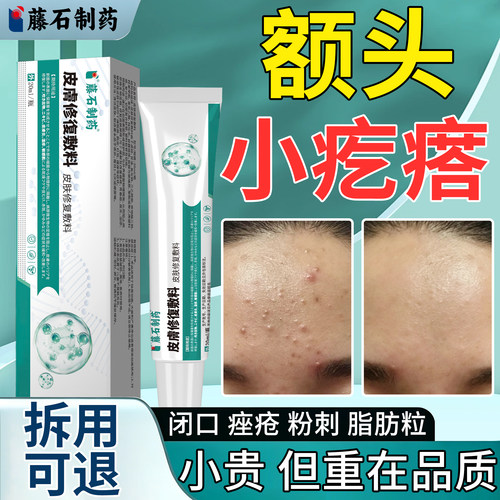 额头闭口小疙瘩脂肪粒