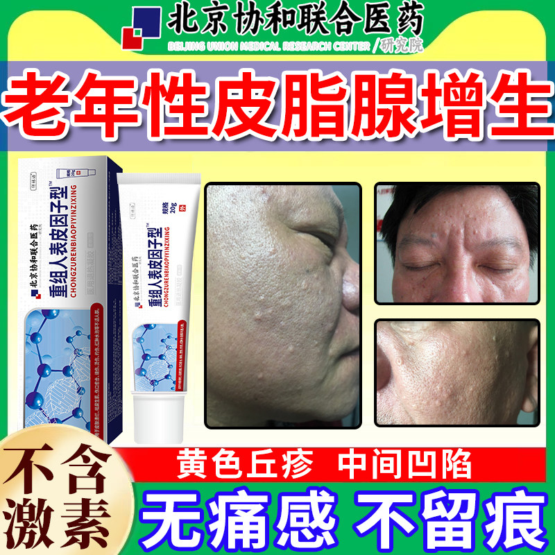 皮脂腺增生增大囊肿黄色丘疹额头脸部男老年性凹陷小疙瘩异位症YU