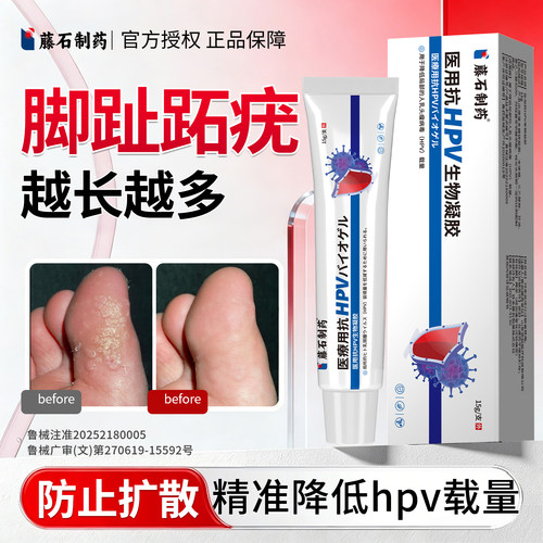 【藤石制药】脚趾长跖疣医用正品