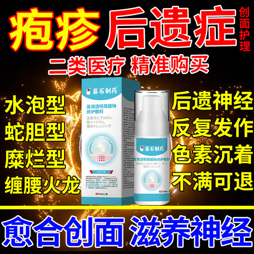 带状疱疹创面泡后遗症神经痛外用春酶用药监备案肽特喷剂修无痛YU