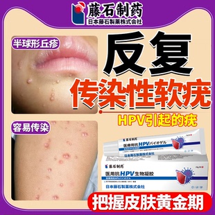 可搭配病毒性传染性软疣幼儿童医用镊子夹子刮勺水瘊子软尤药膏LJ