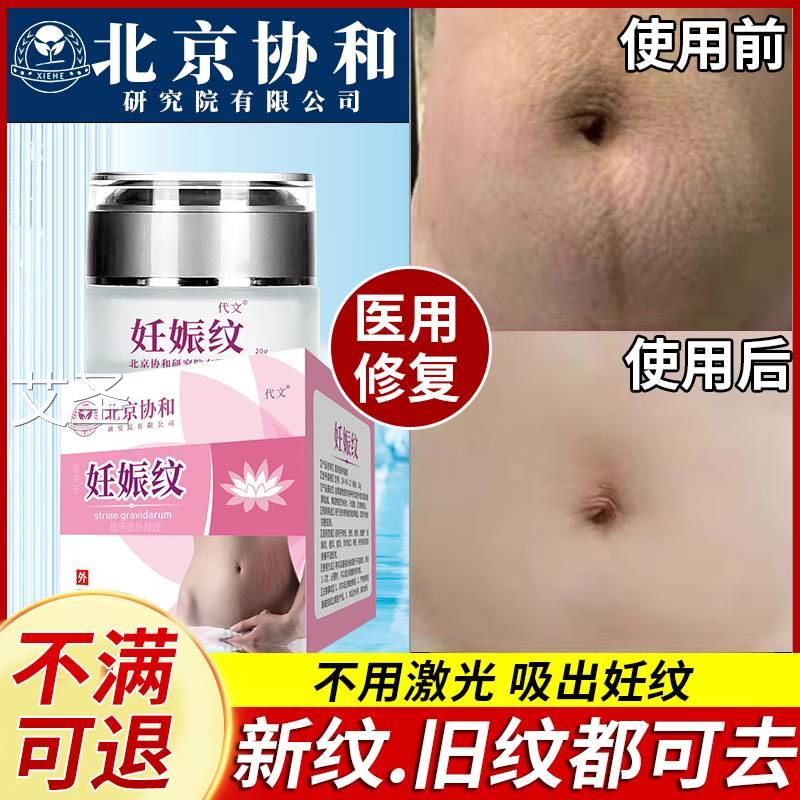 妊娠纹修复霜疤痕修复除疤膏消除妊辰纹去肚子上的紧致肚皮药膏