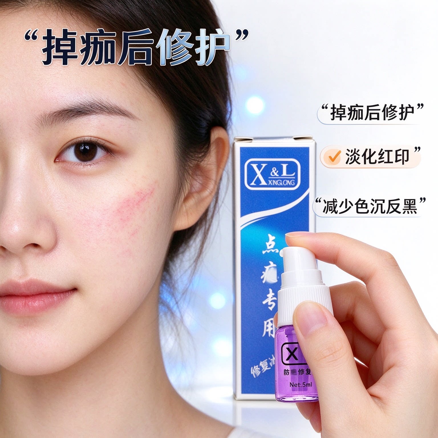 正品XL点痣后修复膏防凹坑疤痕激光扫斑淡化黑红印紫色液专用冰晶