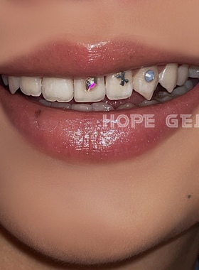 专业牙钻牙饰品贴牙钻diy材料包自己贴套餐hope牙钻闪亮持久小众