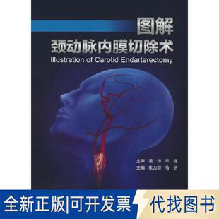 正版全新图解颈动脉内膜切除术（宣武医院脑缺血治疗系列丛书）9787565927652焦力群//马妍北京大学医学出版社有限公司2023-02-01
