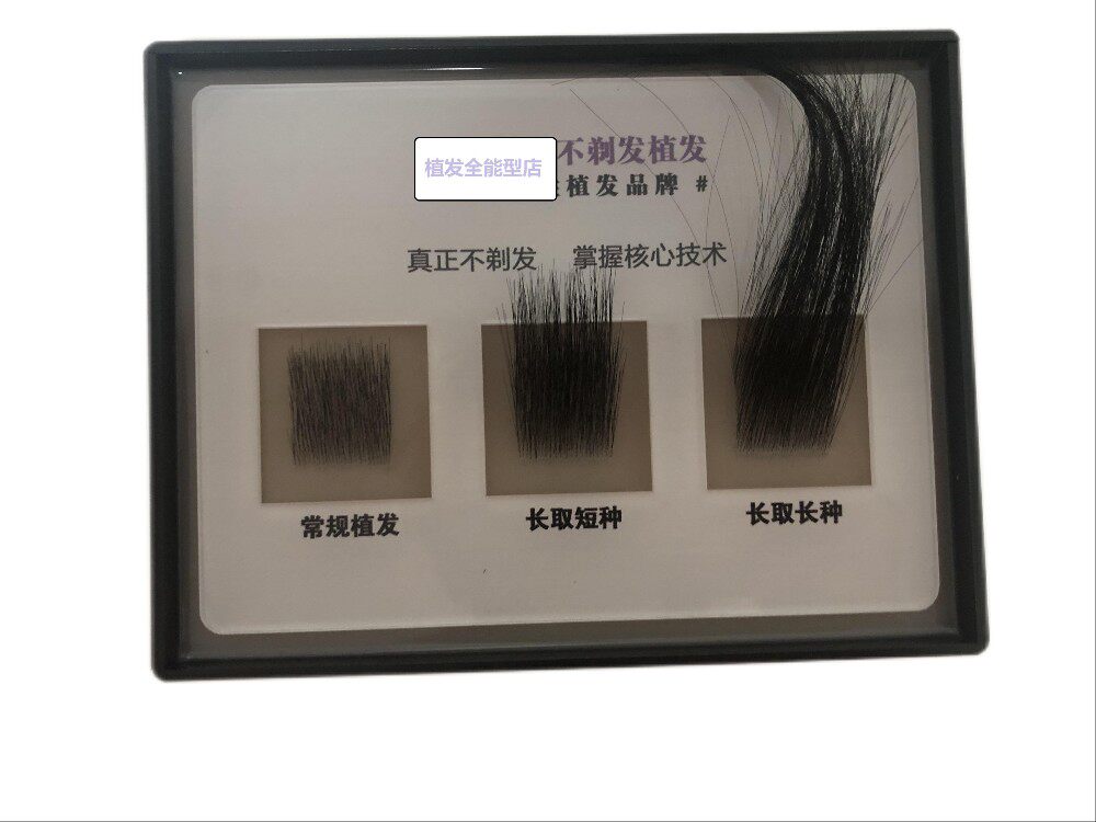 植发密度模型 植发模型 不剃发长发模型图