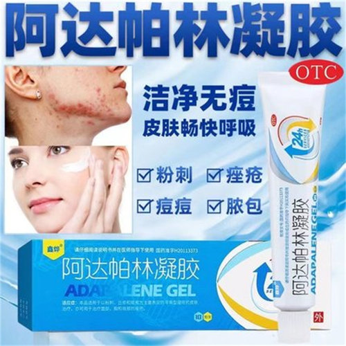 鑫烨 阿达帕林凝胶 0.1%*10g*1支/盒 粉刺丘疹脓包寻常痤疮皮肤