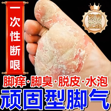 脚气根去专用特效脚痒止痒水泡糜烂脱皮杀菌烂脚丫药真菌感染喷剂