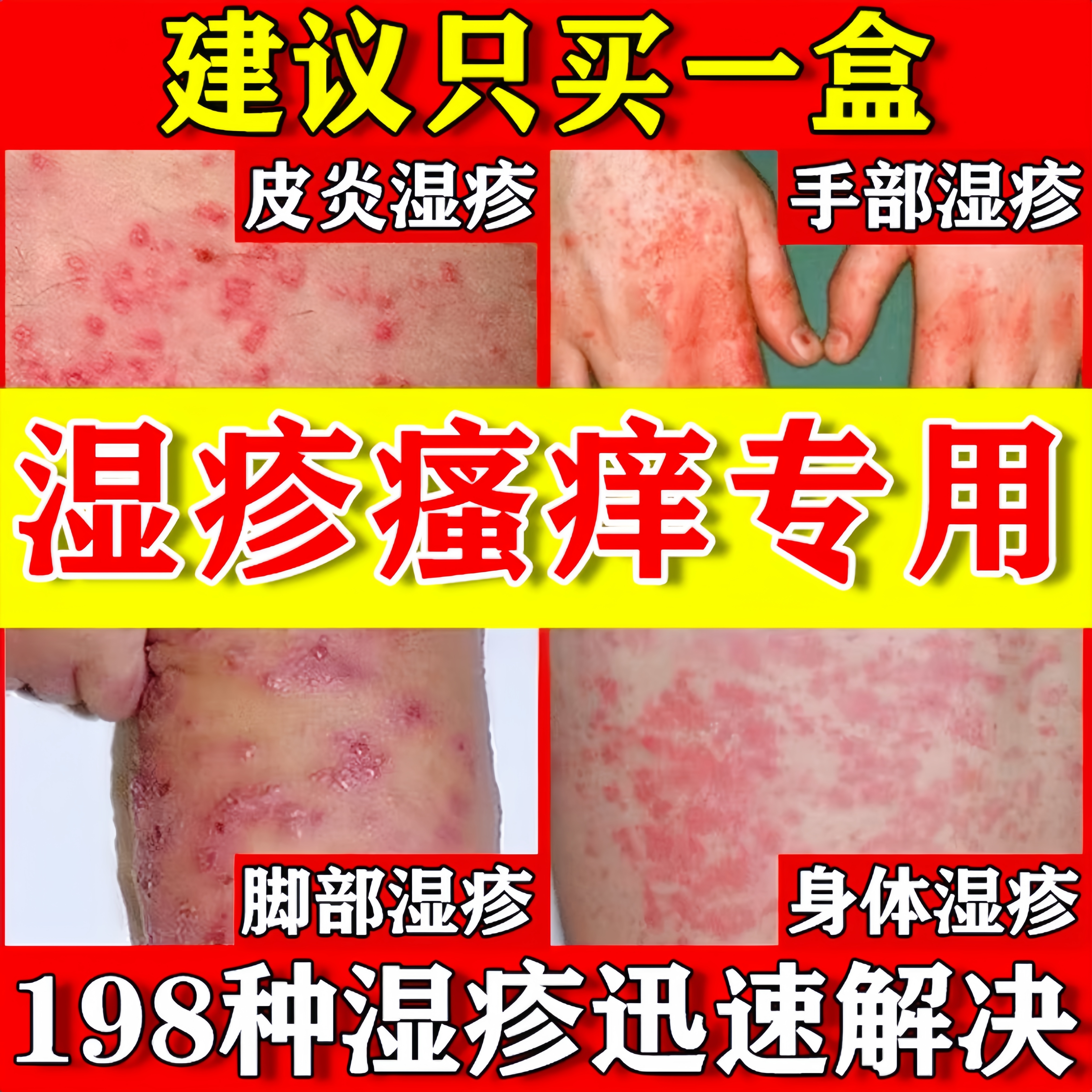 【198种湿痒】8888名客户选择！