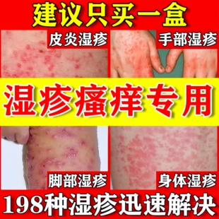 顽选灵湿毒膏药皮肤干燥瘙痒疹湿专用除湿止痒老年人抑菌乳膏