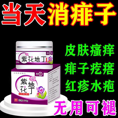 【痱子当天好】消痱止痒专用乳膏