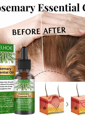Rosemary Hair Care Essential Oil Growth Serum Anti Hair Loss