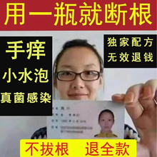 手痒起小水泡手气止痒脱皮杀菌皮肤瘙痒过敏手指长水泡百草止痒膏