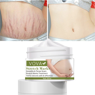跨境vova Remove Stretch Mark Cream  30ml  速卖通 亚马逊 Wish